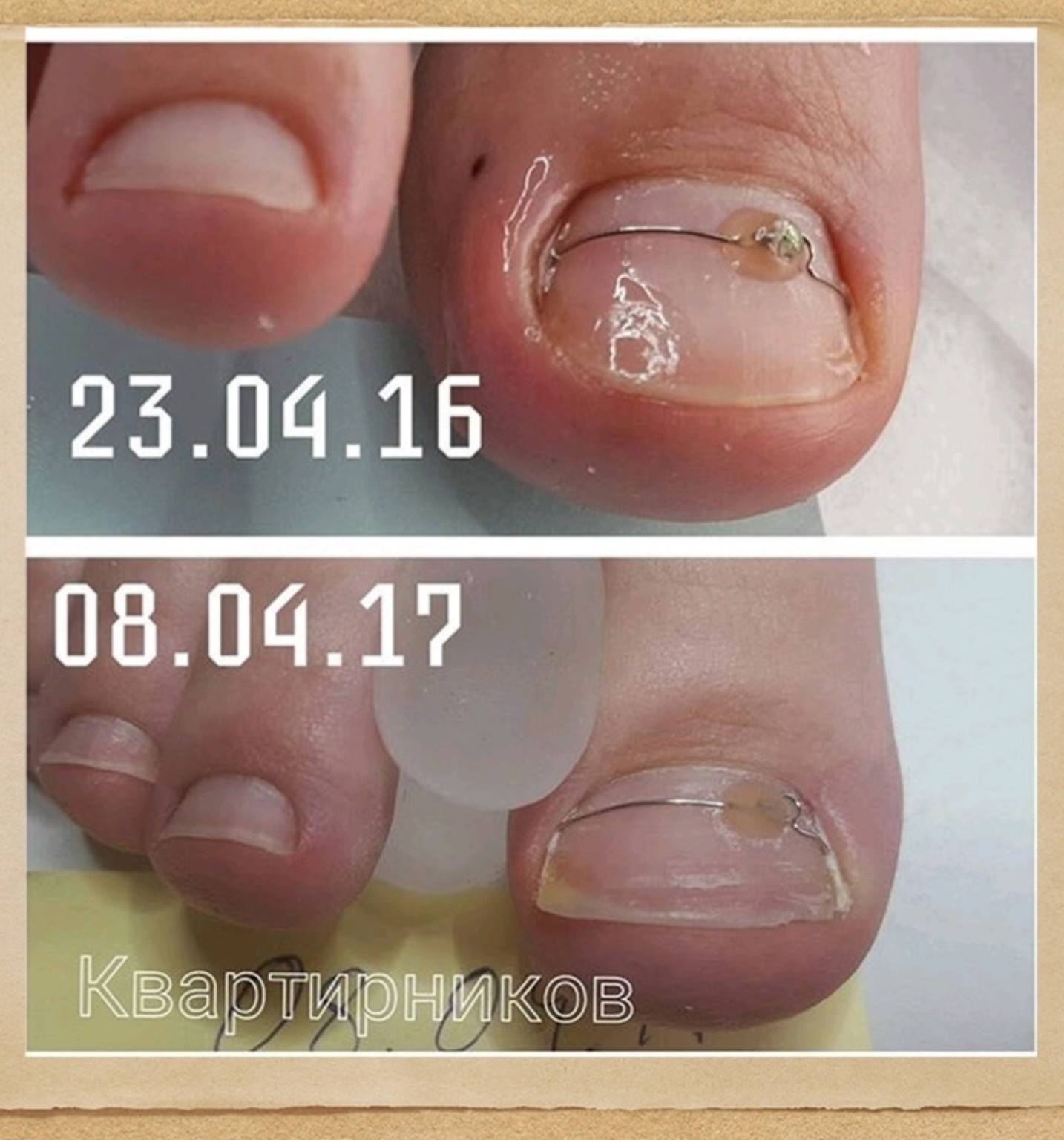 Скоба ORA Omega